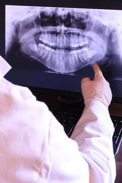 Best Knocked-Out Tooth Emergency  in Vinton, TX